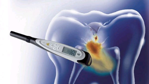 Diagnodent laser cavity detection Willowick OH, dental exam Willowick OH, John L. Wazney DDS, family dentist Lake County OH