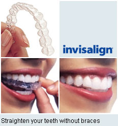 Invisalign preferred provider Cleveland, Invisalign dentist Cleveland, John L. Wazney DMD