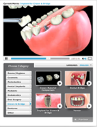 Dental Videos for NSImplant.com