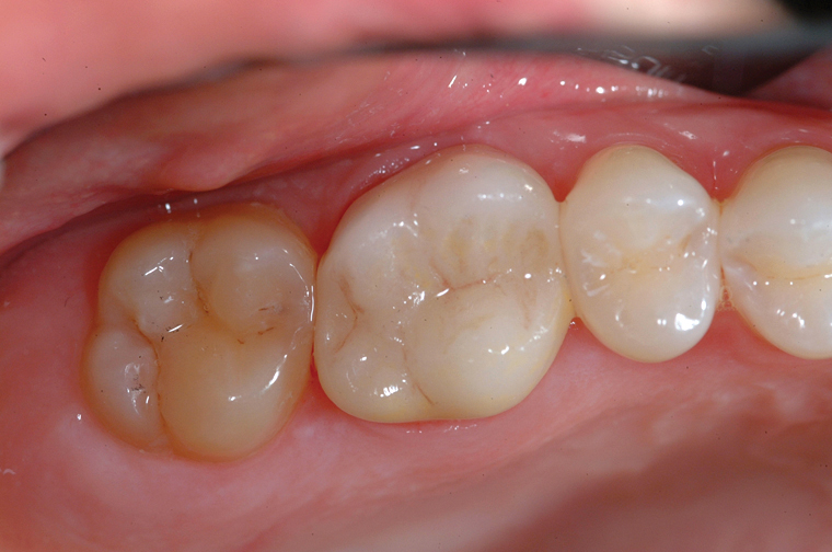Family and Cosmetic Dentistry, Kirkland, Washington, Dr. Louis K. Cheung DDS
