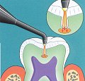 Diagnodent - Perfect Smiles Dentistry Serving Westport, Seekonk, Fall River, New Bedford, MA, Providence, RI