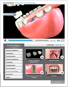 Dental VIdeos ~ Dentist in Lompoc Ca